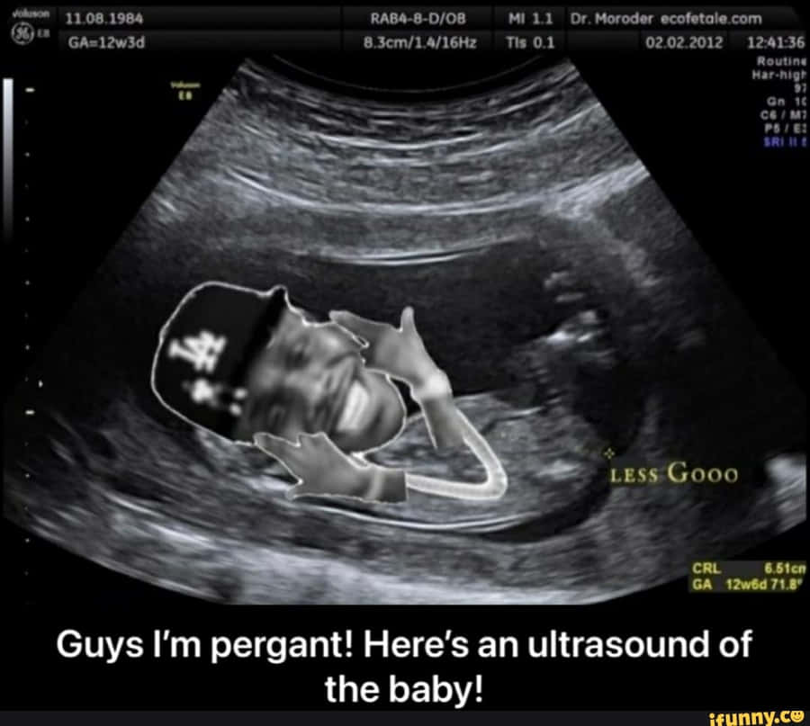 Free Funny Ultrasound Pictures , [100+] Funny Ultrasound Pictures for FREE  