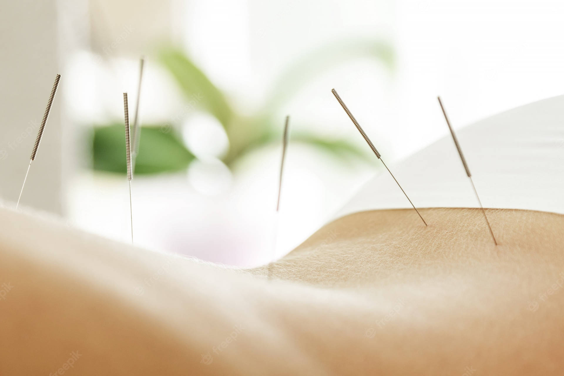 Acupuncturist Wallpaper