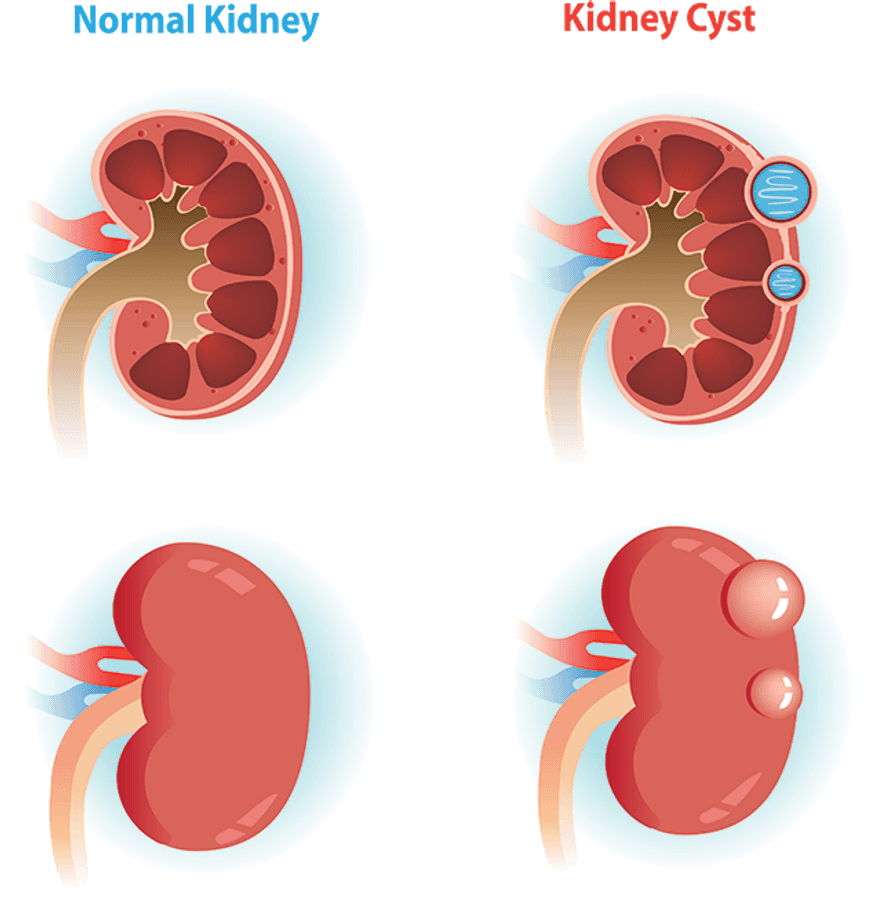 Kidney Png