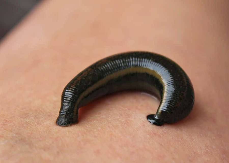 En igle fastgjort til menneskelig hud til medicinsk behandling. — Leech Wallpapers