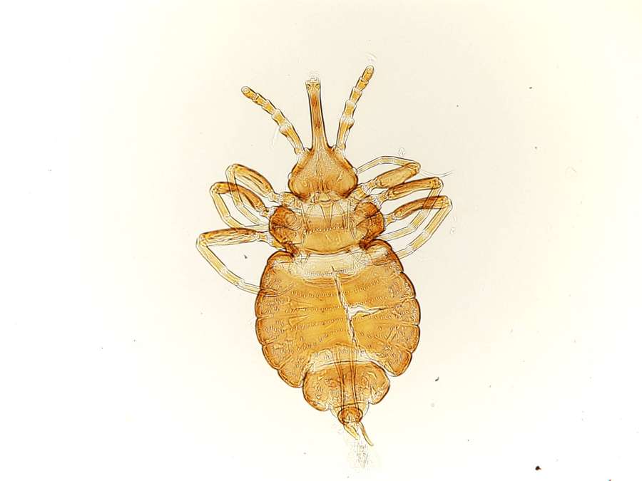 A magnified view of a translucent amber-colored louse on a plain background. — Louse Wallpaper