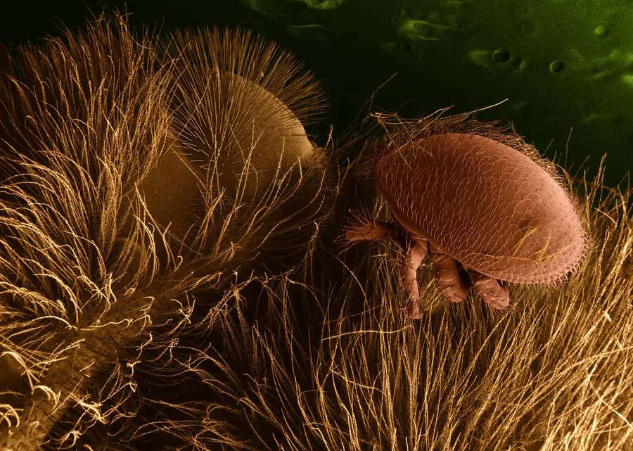 A microscopic mite on hair-like fibers under magnification. — Mite Wallpaper