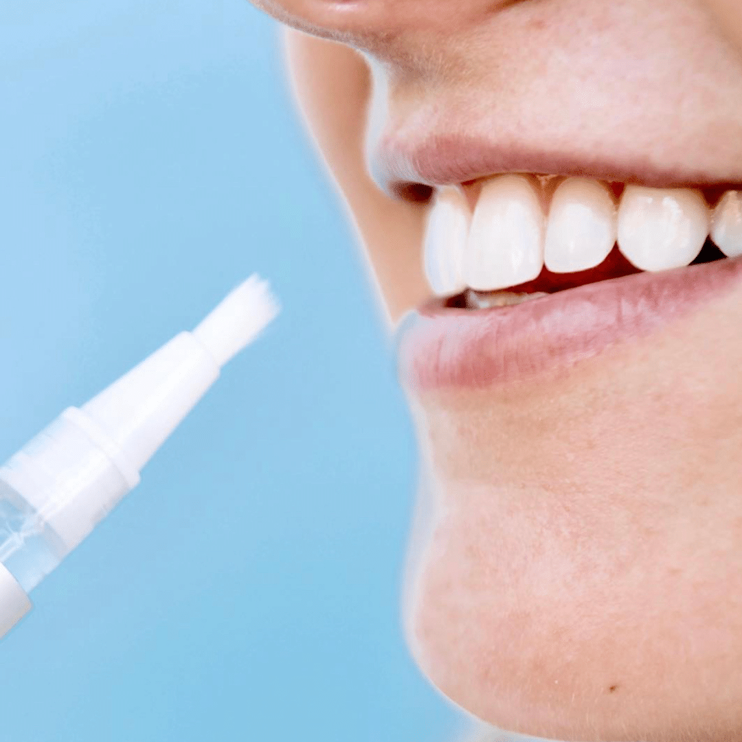 A Sparkling Smile After Teeth Whitening Wallpaper