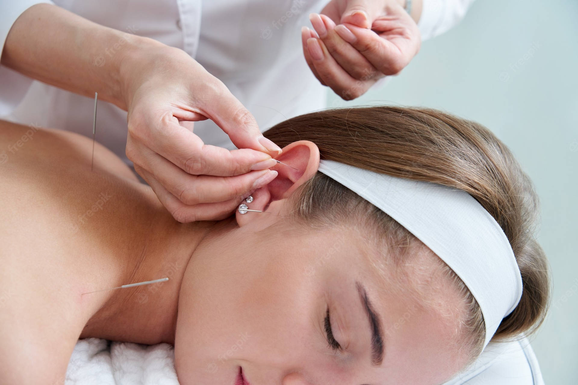 A Professional Acupuncturist Administering Ear Needle Treatment Wallpaper