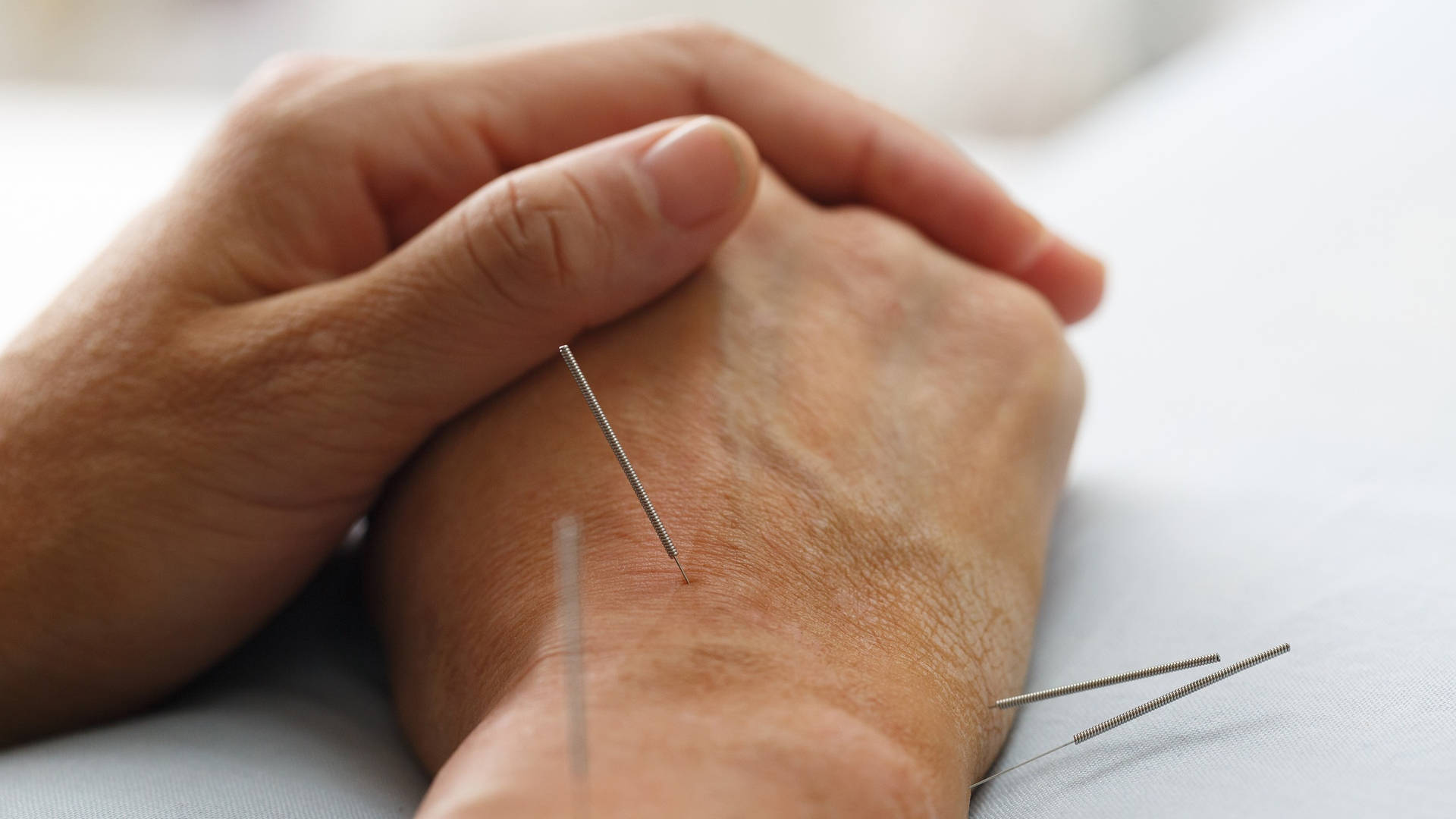 Acupuncturist Performing Hand Therapy Wallpaper