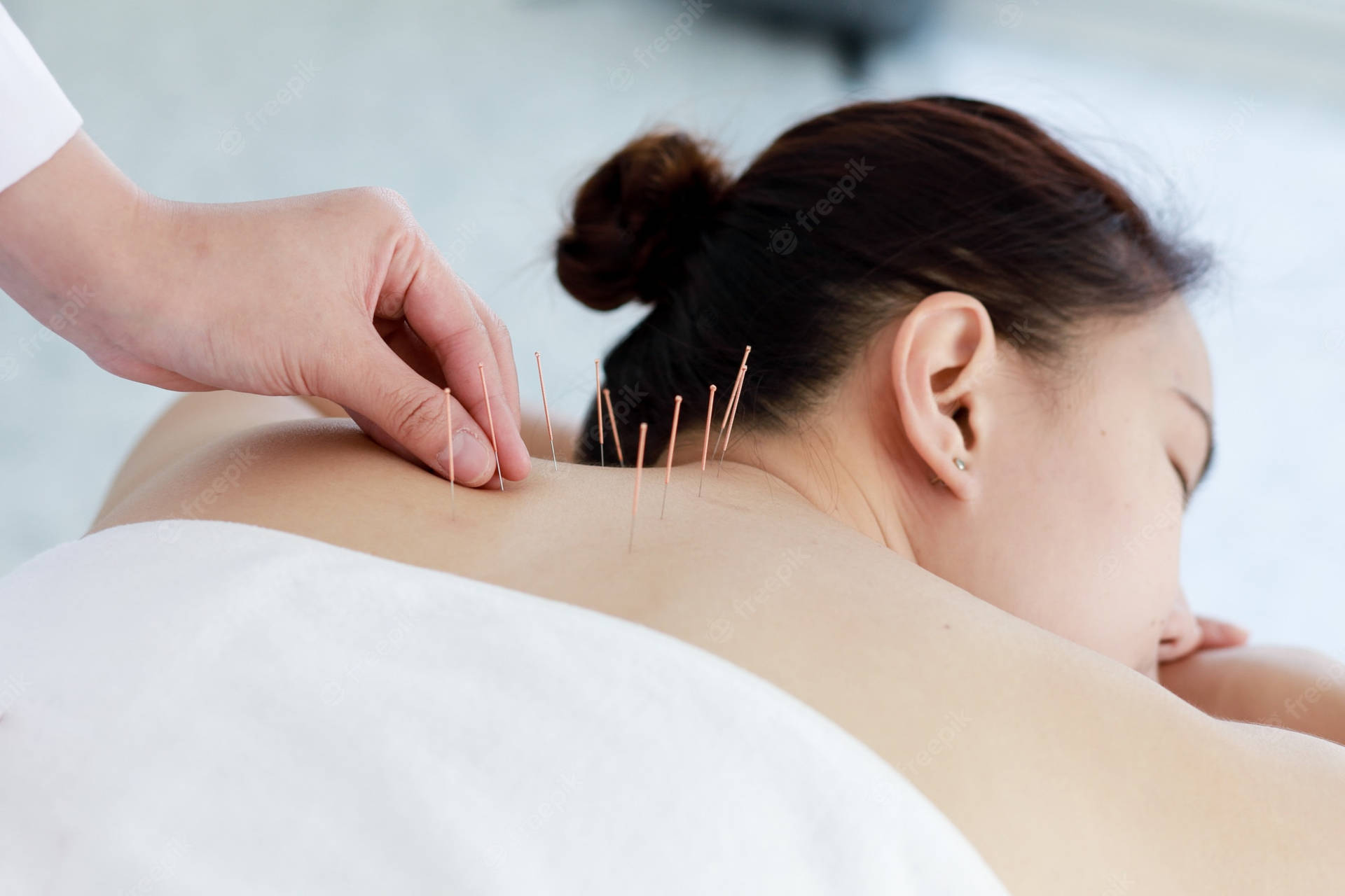 Acupuncturist Neck Therapy Wallpaper