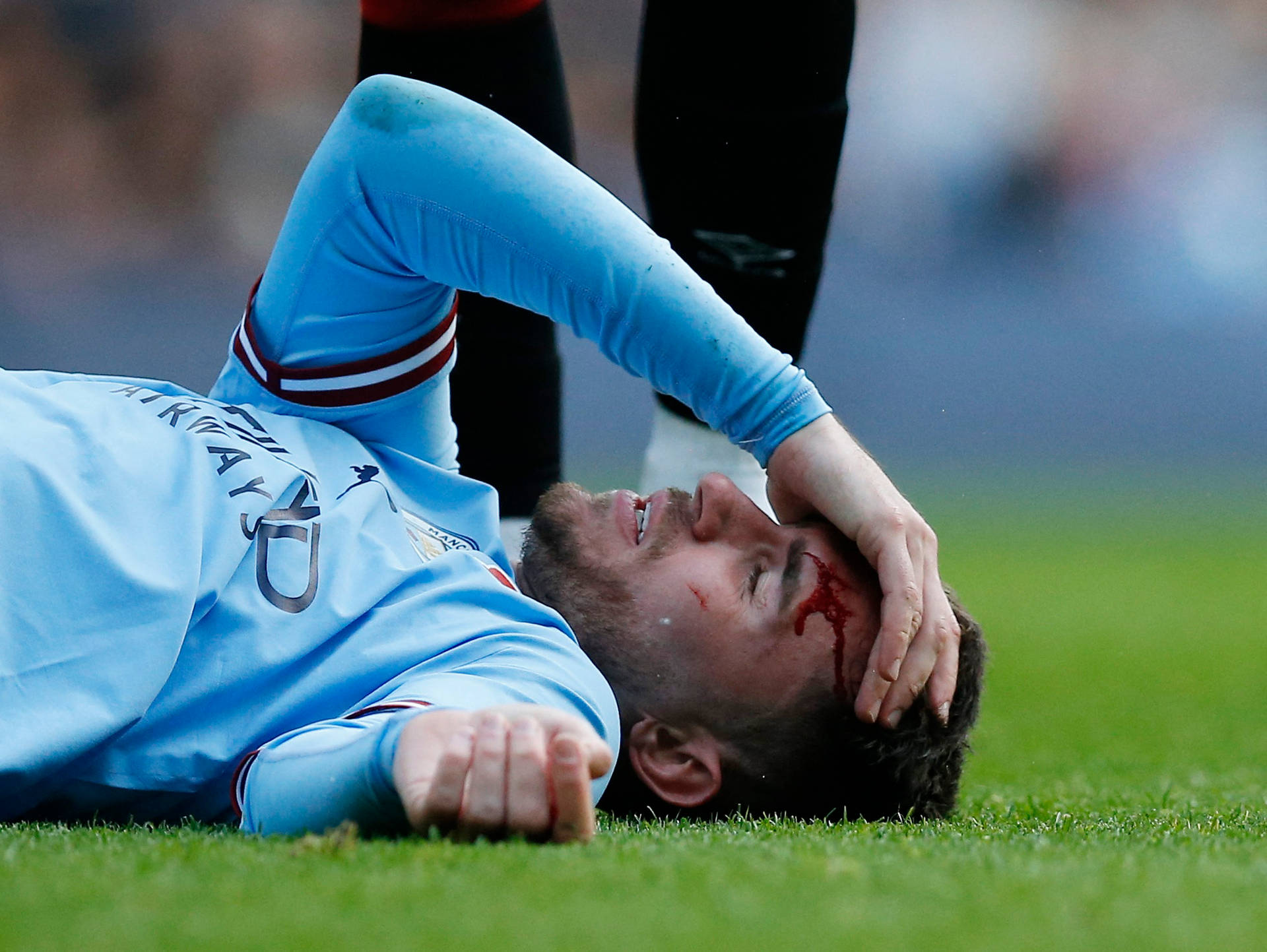 Aymeric Laporte With Wounded Head Wallpaper