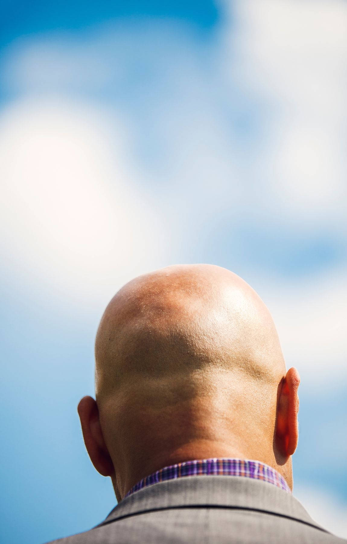 Bald Man And Blue Sky Picture
