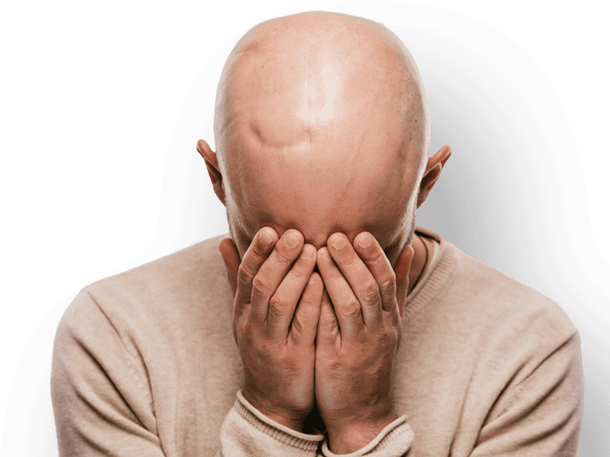 Bald Man Covering Face With Hands PNG
