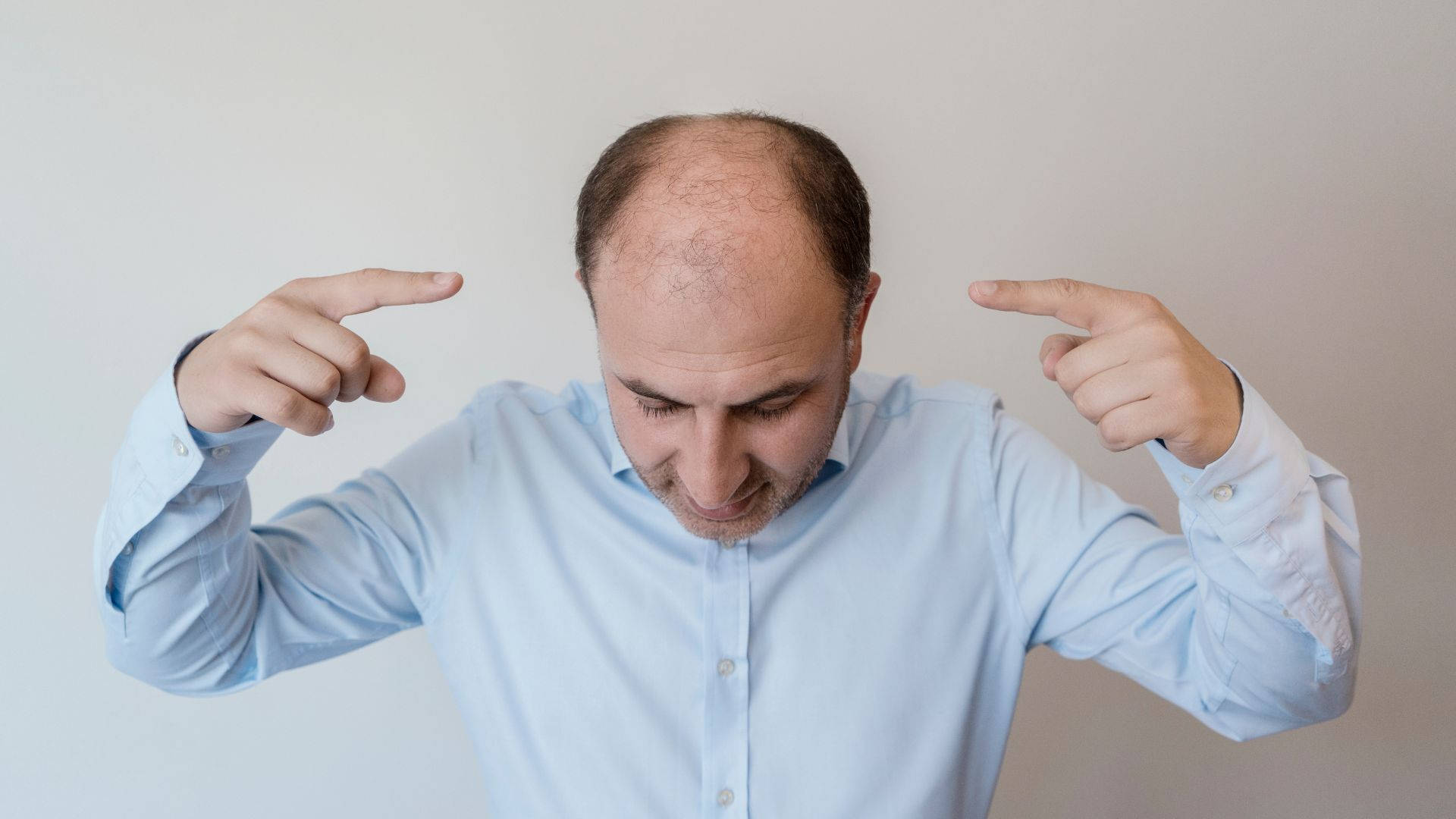 Bald Man Pointing At His Head Wallpaper