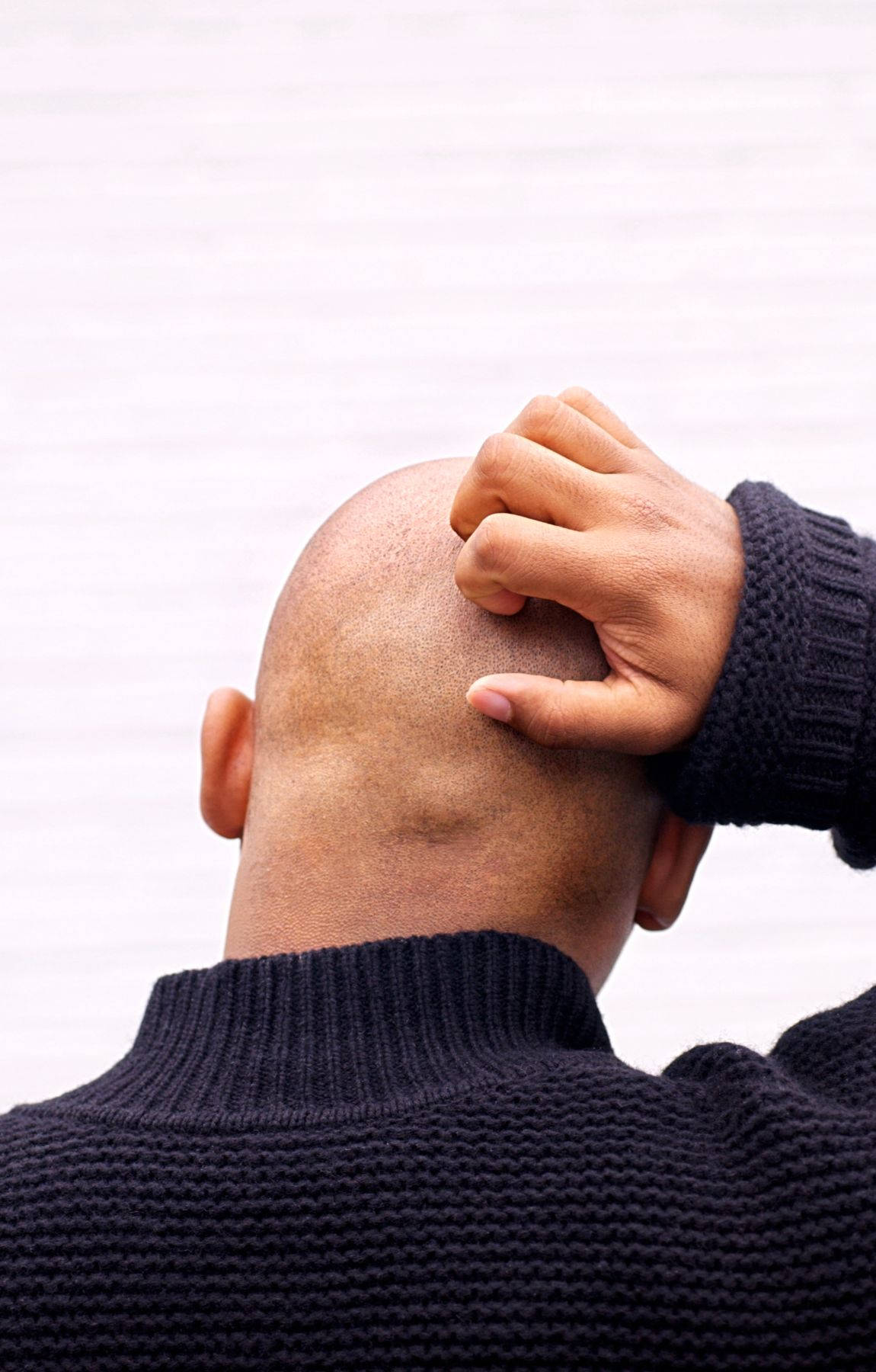 Bald Man Scratching His Head Picture