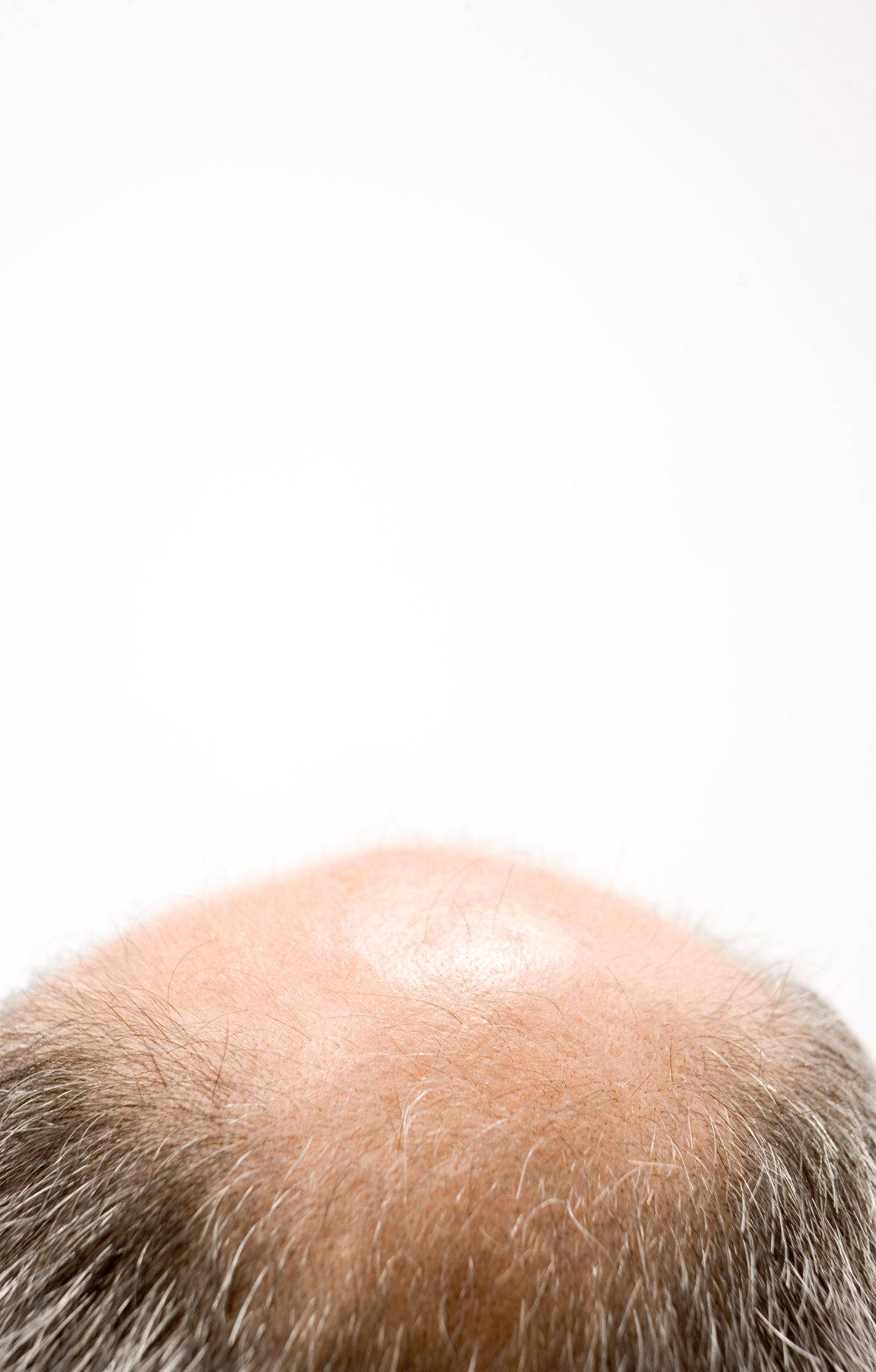 Bald Man With Thinning White Hair Picture