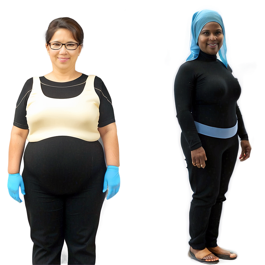 Bariatric Surgery Before And After Png Kjj PNG