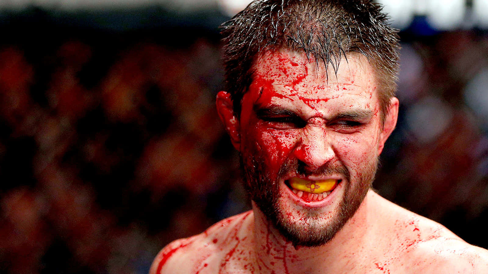 Bloody Professional Mixed Martial Artist Carlos Condit Picture