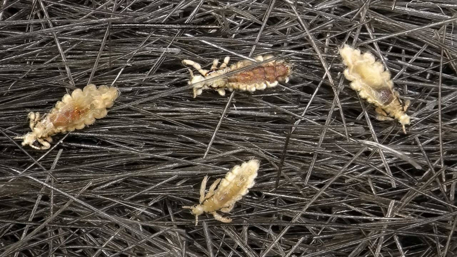 Microscopic View of a Body Louse on Haystack Wallpaper