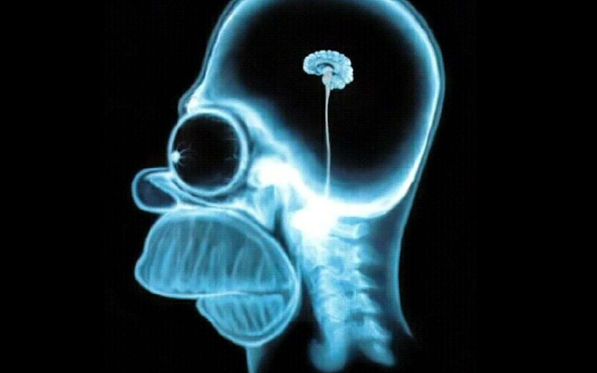 Unaimagen De Rayos X De Un Cráneo Con Un Cráneo Fondo de pantalla