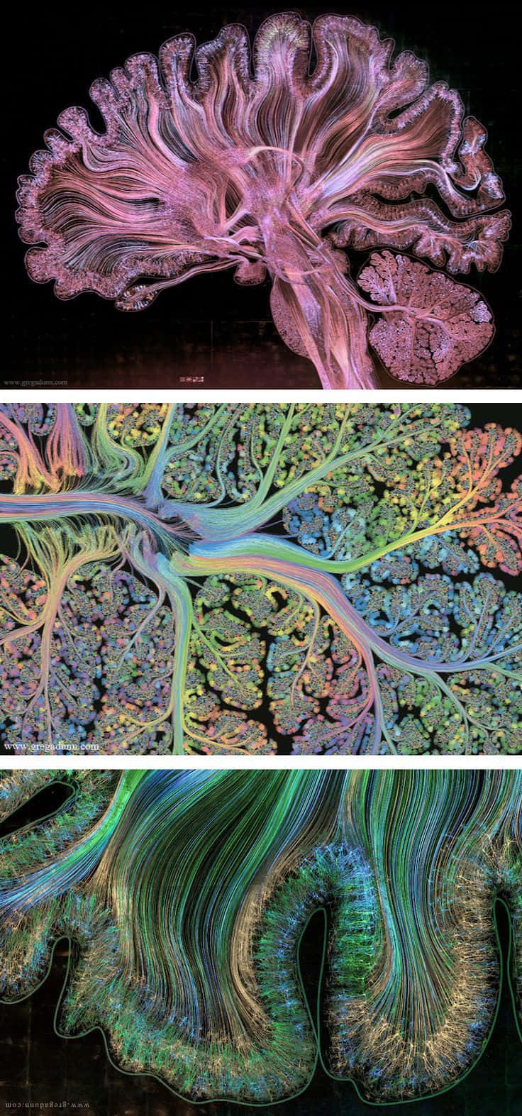 A Series Of Images Of The Brain