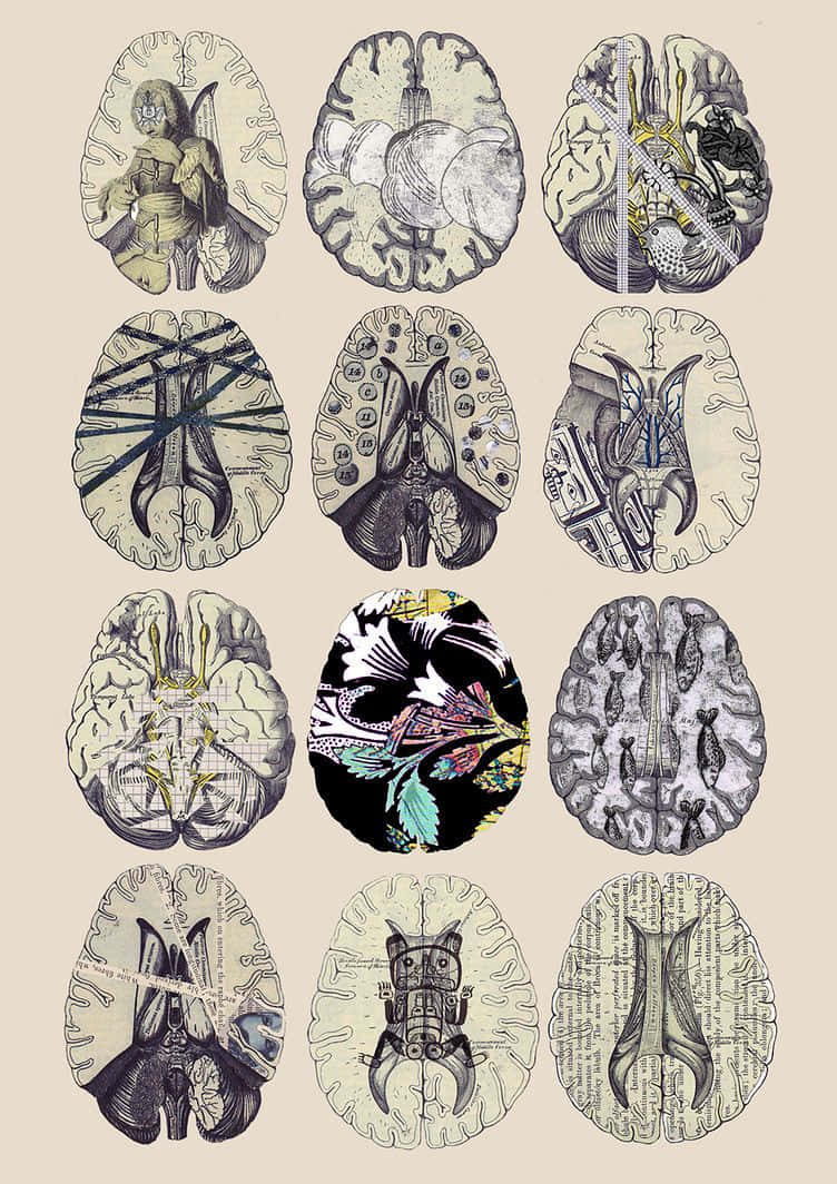 En række tegninger af hjerner med forskellige designs