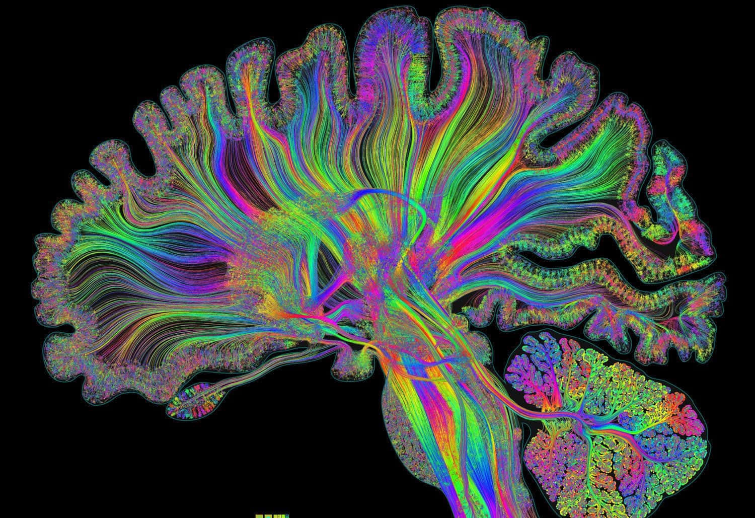 Unaimagen Colorida De Un Cerebro
