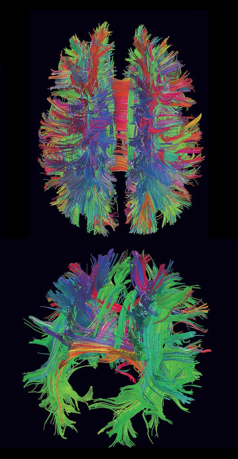 A Brain With Colorful Coloured Strands