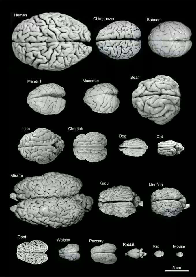 Different Brain Picture
