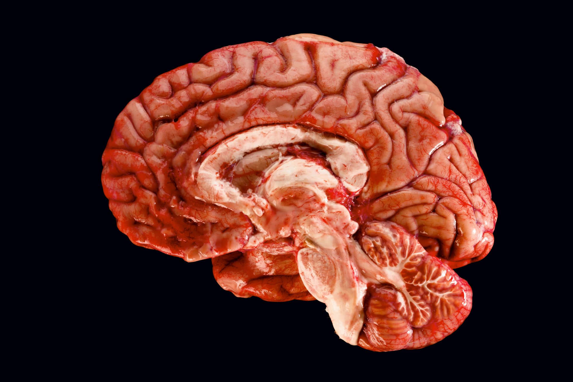 Einmenschliches Gehirn Wird Auf Einem Schwarzen Hintergrund Gezeigt. Wallpaper