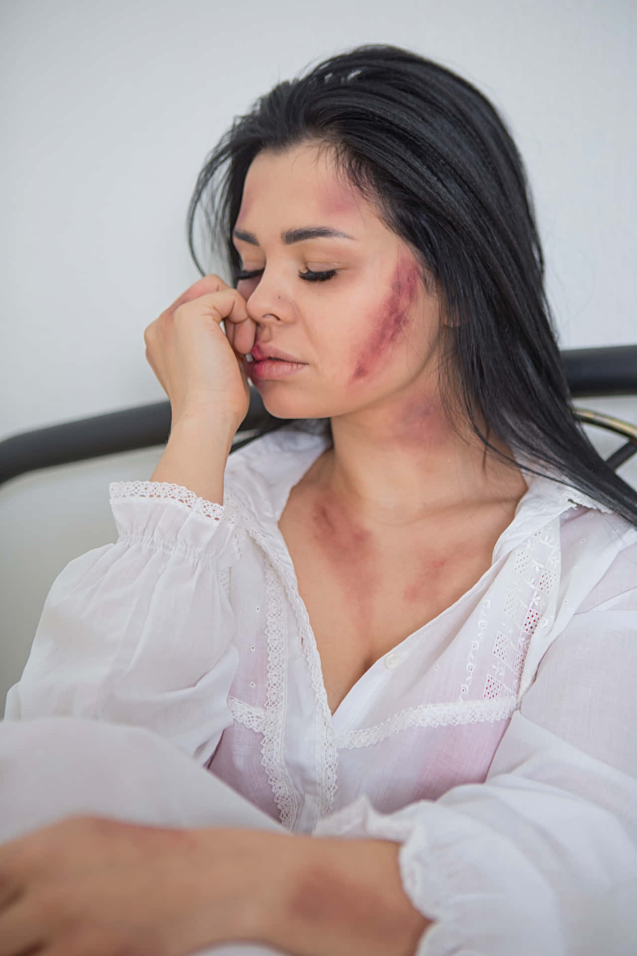 Bruised Girl In White Polo Wallpaper