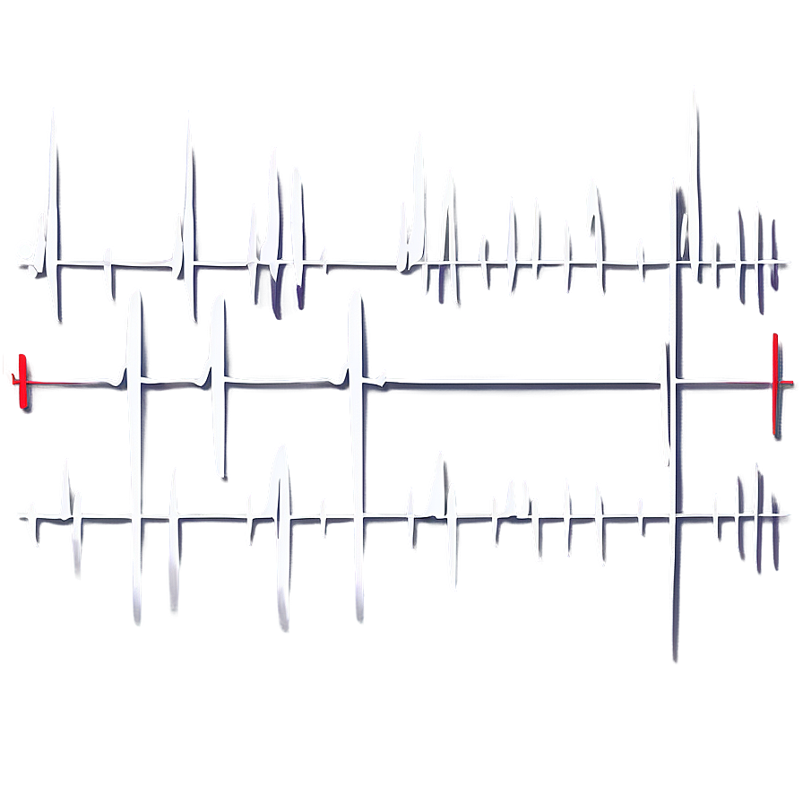 Cardiac Pulse Waveform Png 21 PNG