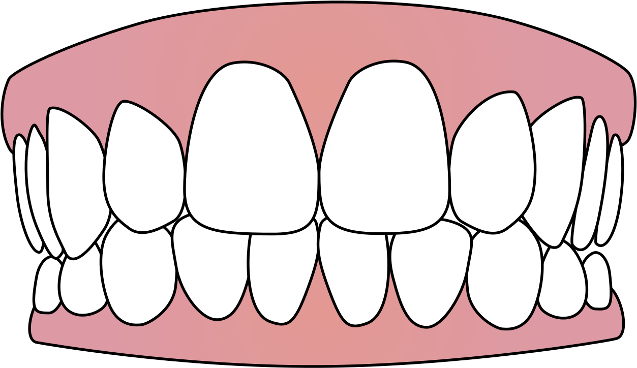 Cartoon Smile Teeth Illustration.png PNG