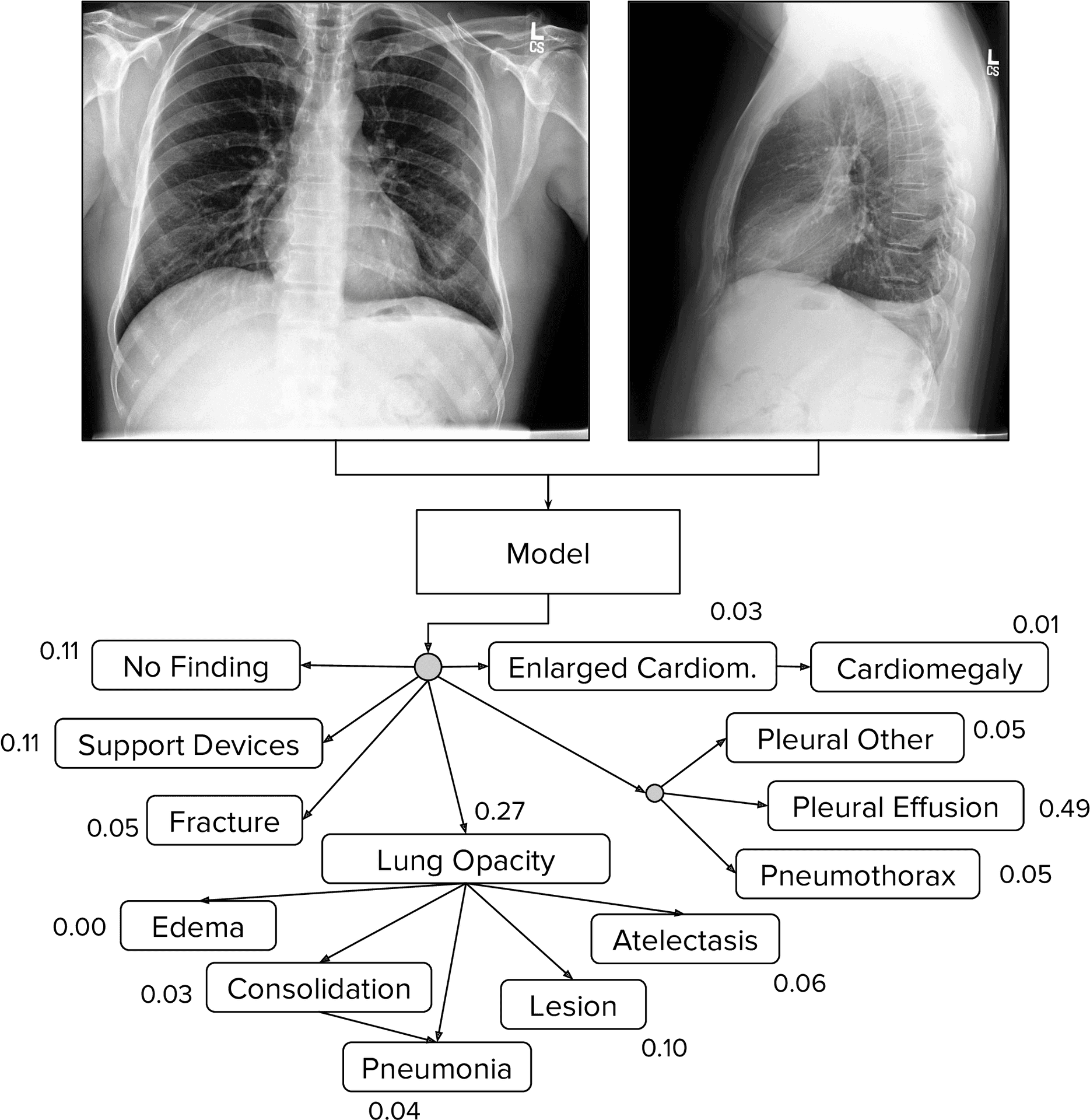 Chest Xray Diagnostic A I Analysis PNG