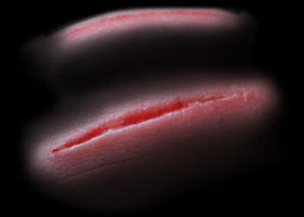 Close Up Healing Scar PNG