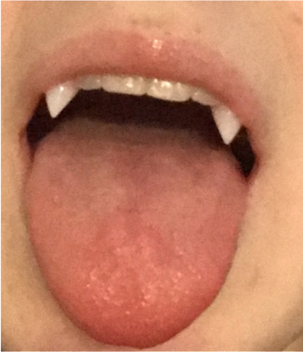 Close Up Tongue Piercing PNG