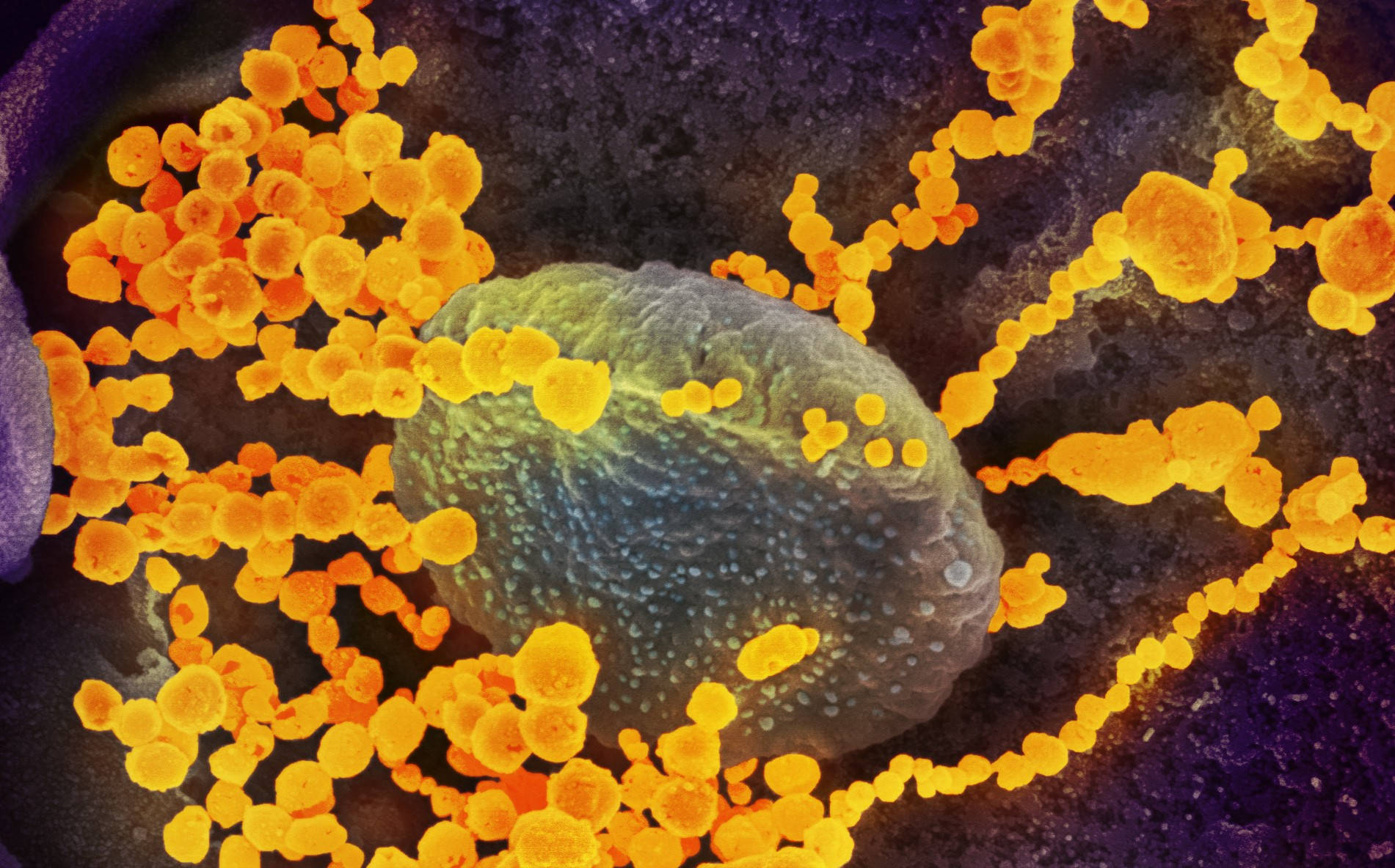 Coronavirus Yellow Particles Background