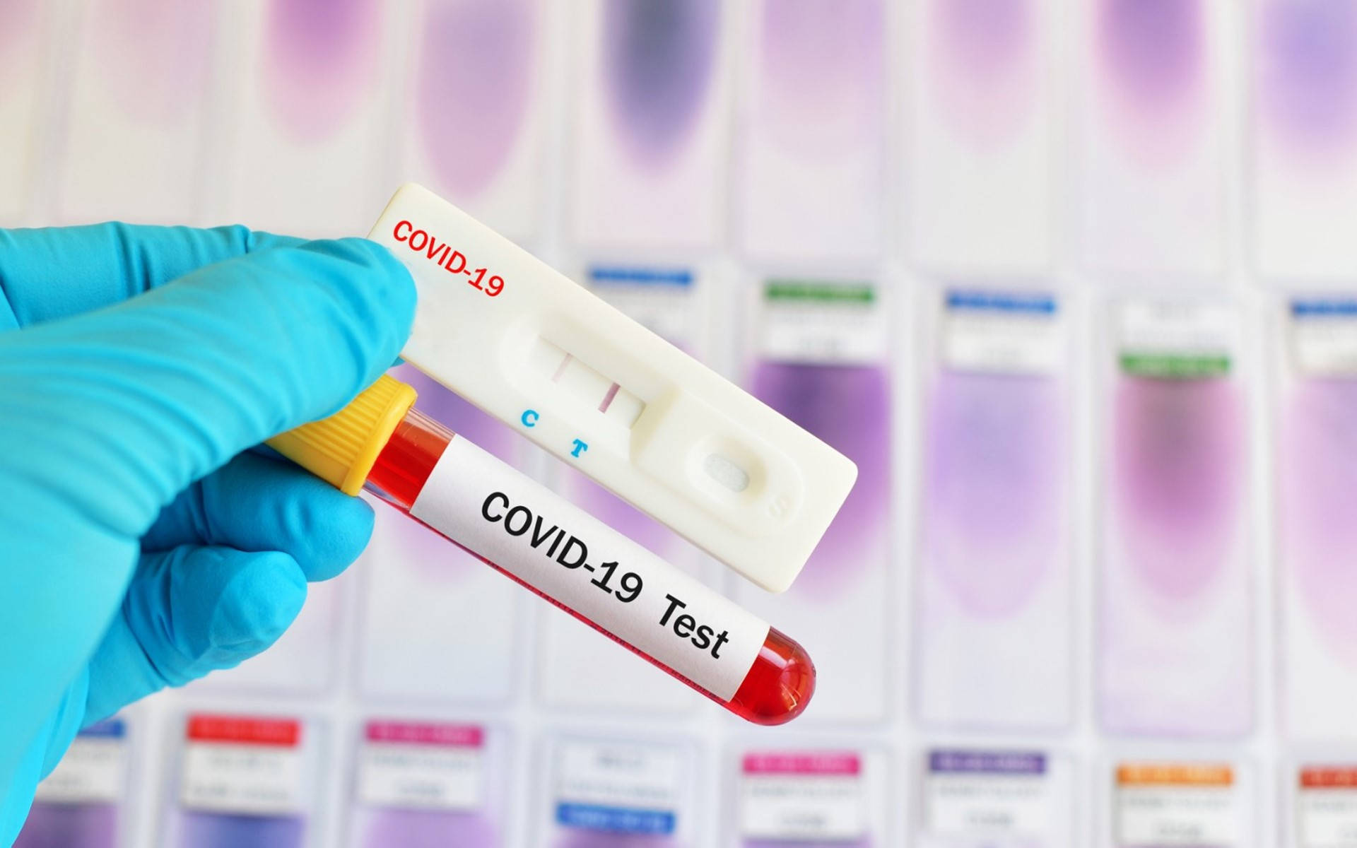 Crucial COVID-19 Test Kit with Red Vial Wallpaper