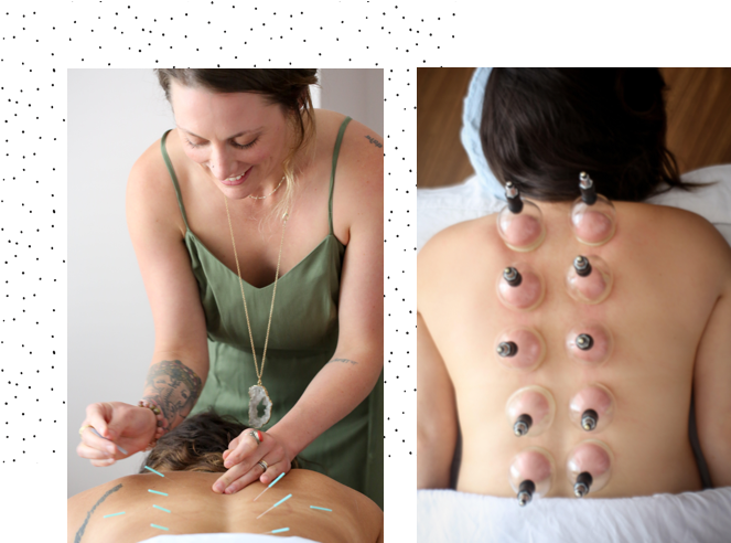 Cupping_and_ Acupuncture_ Therapy_ Session PNG