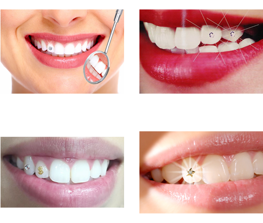 Dental Care Procedures Collage PNG