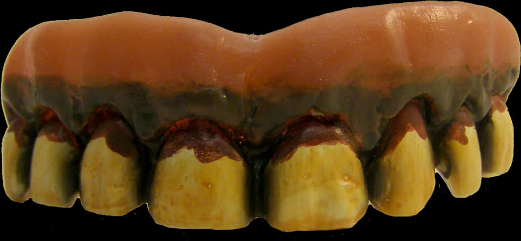 Dental Prosthesis Upper Arch PNG