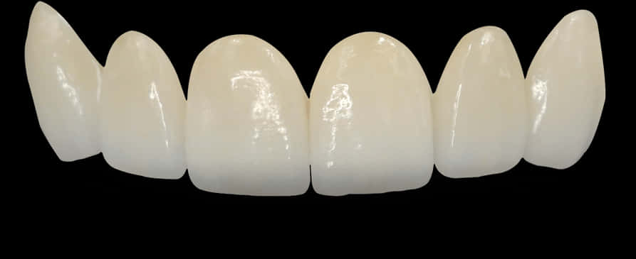 Dental Veneers Set PNG