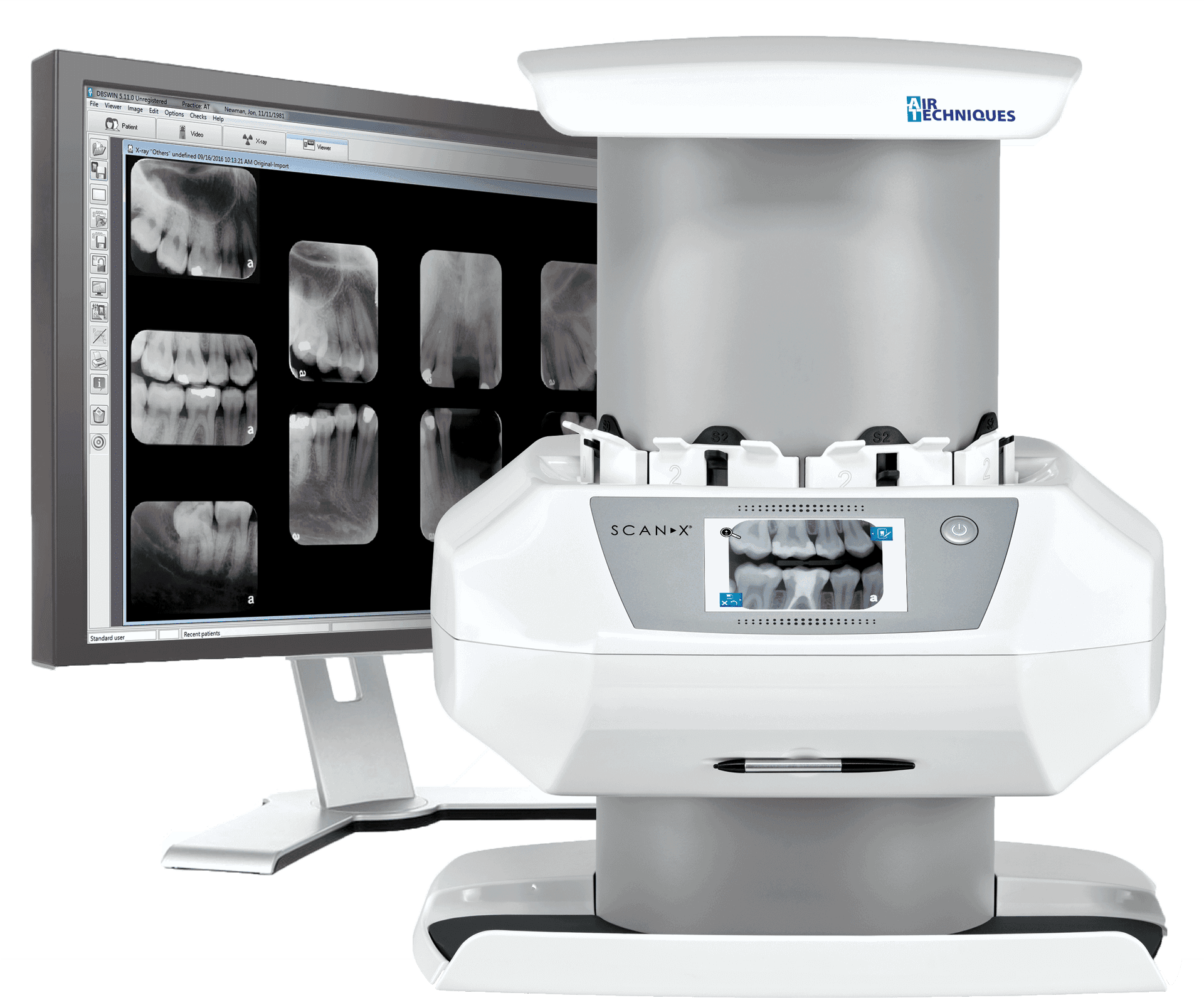 Dental Xray Scannerand Monitor Setup PNG
