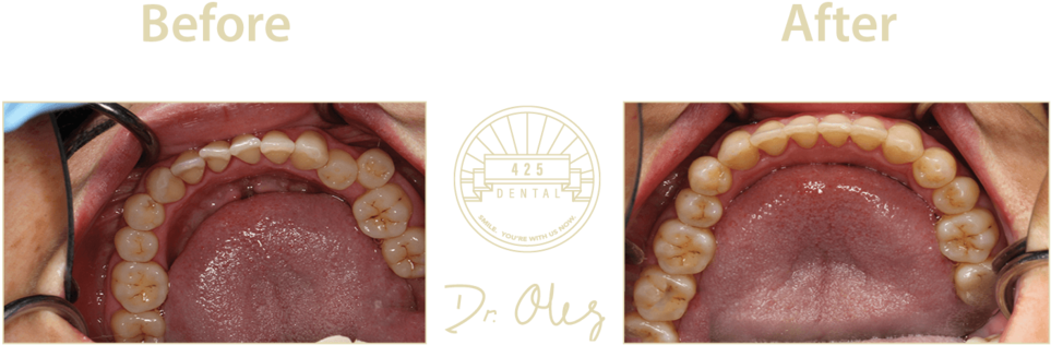 Dental_ Treatment_ Before_ After_ Dr_ Olly PNG