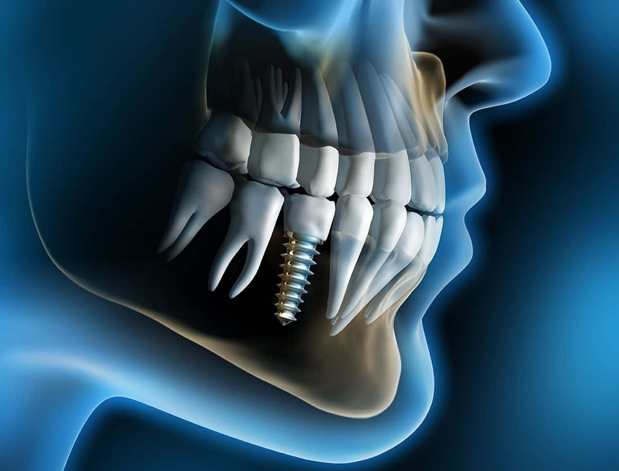 Dentistarealizando Un Procedimiento Dental En Un Paciente