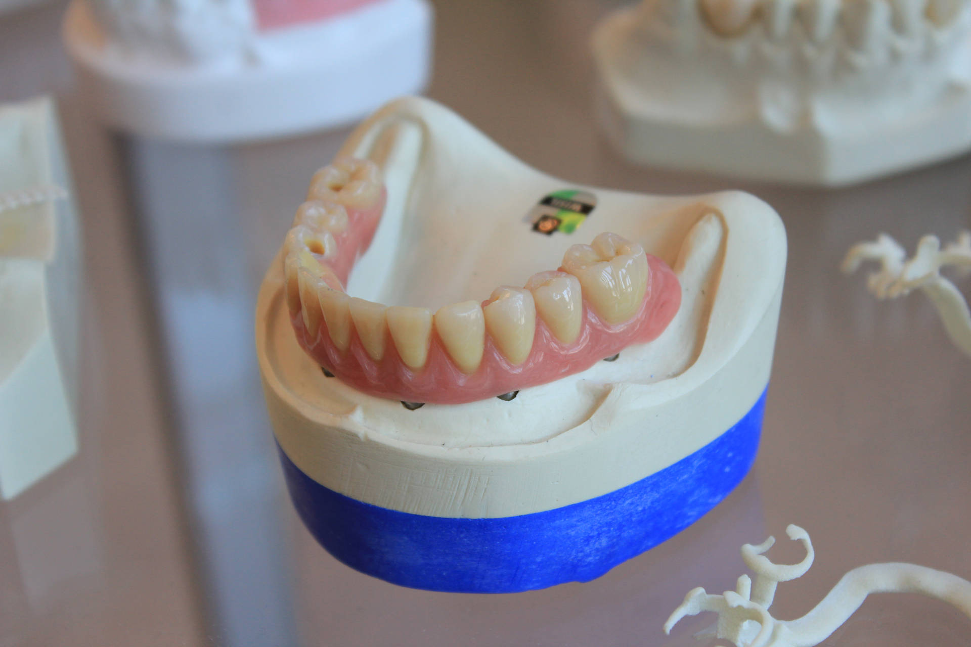 Tandlægemodel af underkæbeprotese. Wallpaper