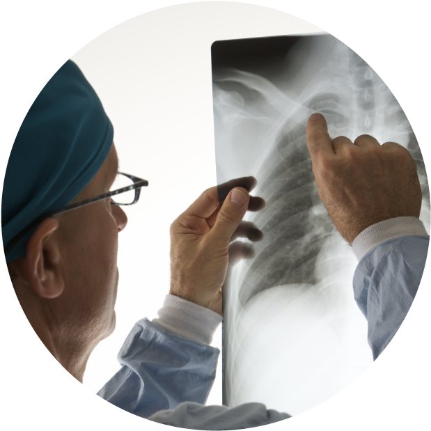 Doctor Examining Chest Xray PNG