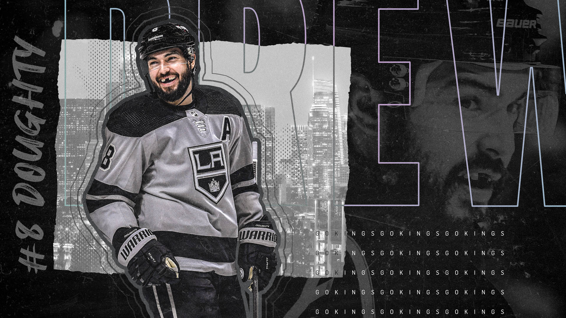 Drew Doughty lost another tooth! Still gorgeous