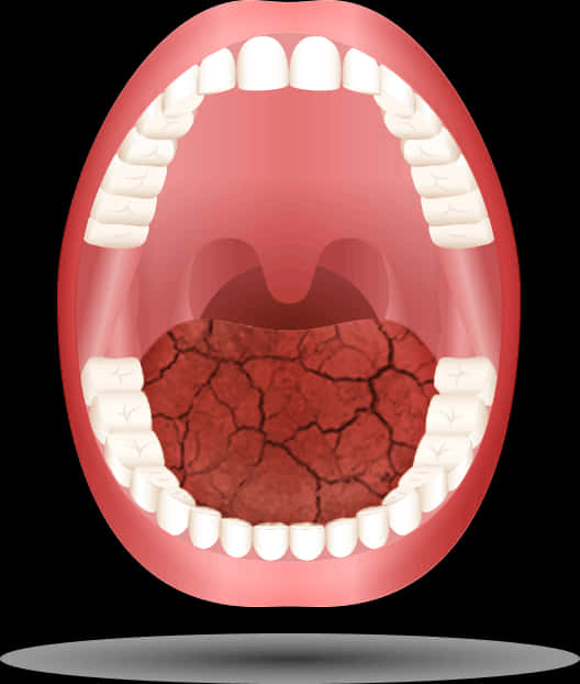 Dry Mouth Illustration PNG