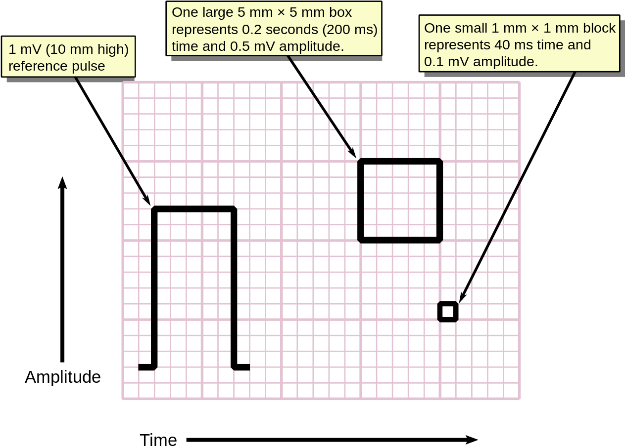 E C G Graph Paper Scale Explanation PNG