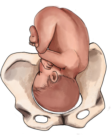 Fetal Positionin Pelvis PNG