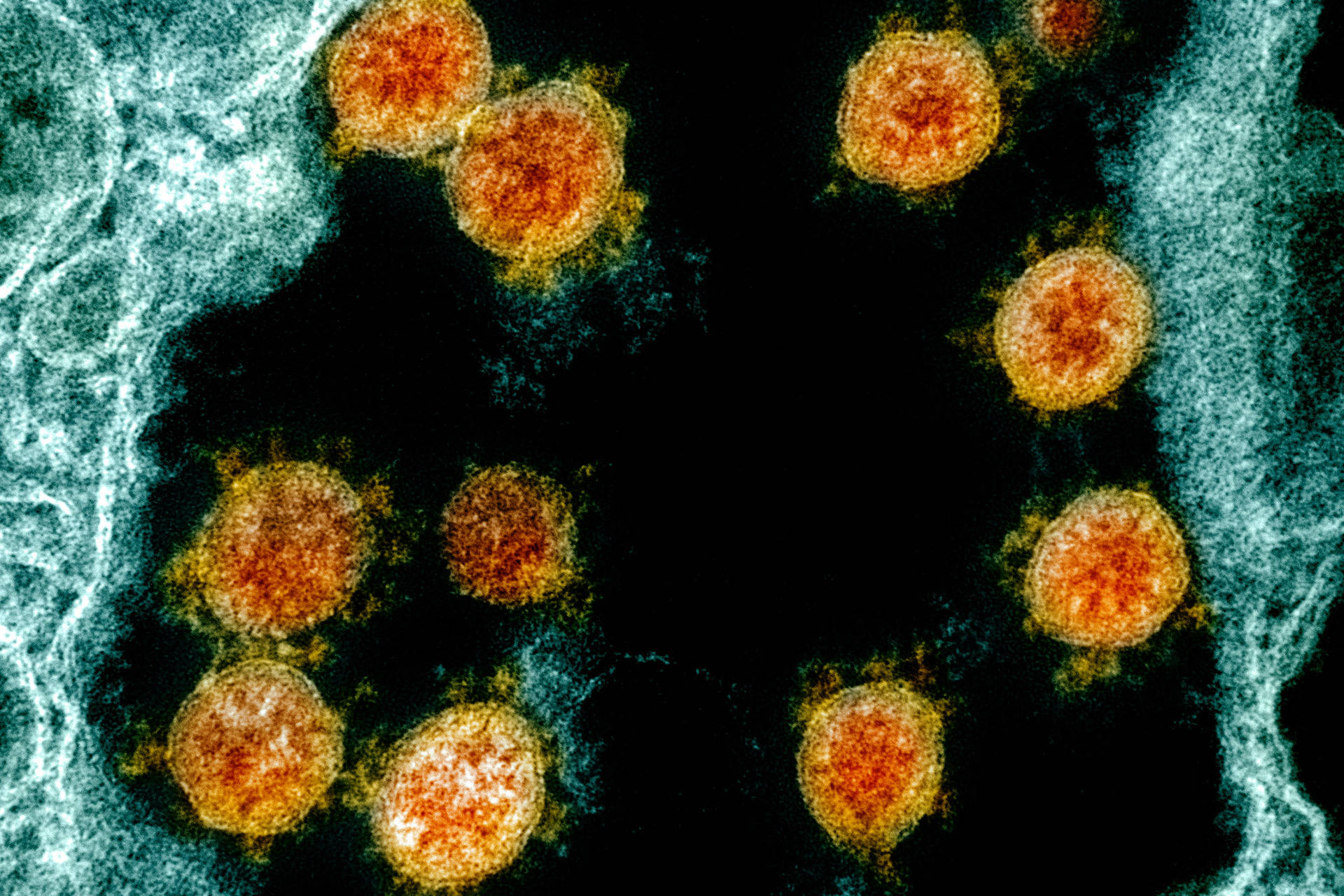 Fiery Coronavirus Model Background