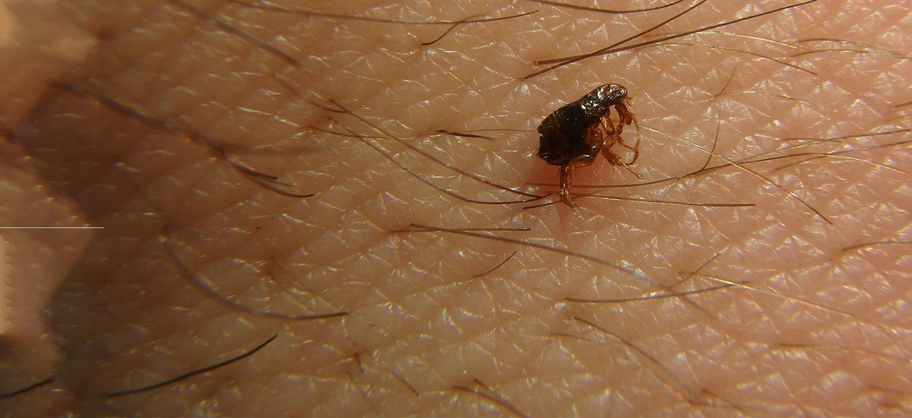 Flea Sucking A Human Skin Wallpaper