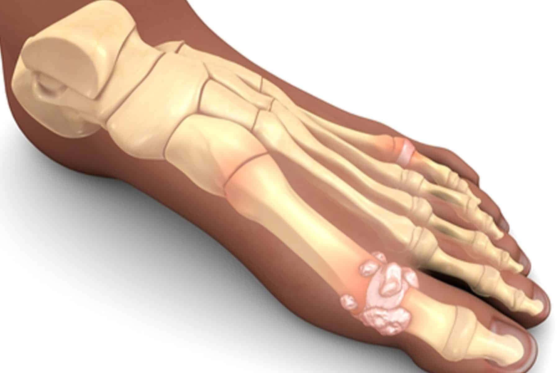 Digitalesbild Eines Fußknochen
